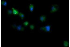 Image no. 1 for anti-RIO Kinase 2 (RIOK2) (AA 277-552) antibody (ABIN1491305) (RIOK2 antibody  (AA 277-552))