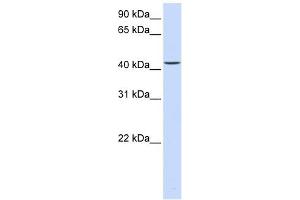 PARVB antibody used at 1 ug/ml to detect target protein. (Parvin, beta antibody  (C-Term))