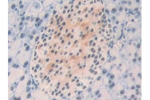 Immunohistochemistry (IHC) image for anti-Nucleophosmin (Nucleolar phosphoprotein B23, Numatrin) (NPM1) (AA 212-292) antibody (ABIN7438103)