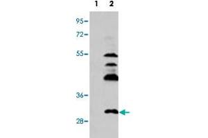Western blot analysis of UCK2 (arrow) using UCK2 polyclonal antibody .