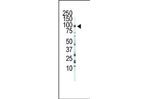 Western blot analysis of anti-FGFR3 Pab (ABIN391969 and ABIN2841765) in Jurkat cell lysate. (FGFR3 antibody  (C-Term))