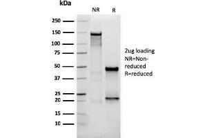 SDS-PAGE Analysis Purified Vimentin Mouse Monoclonal Antibody (VIM/3736). (Vimentin antibody  (AA 2-466))