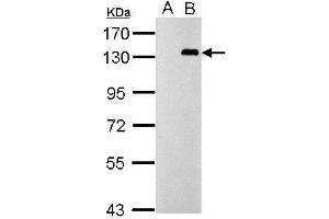 WB Image Sample (30 ug of whole cell lysate) A: Non-transfected 293T lysates B: TLR9 transfected 293T lysates 7. (TLR9 antibody  (N-Term))