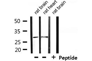 Western blot analysis of extracts from rat brain, rat heart, using TNFRSF9 Antibody. (CD137 antibody  (Internal Region))