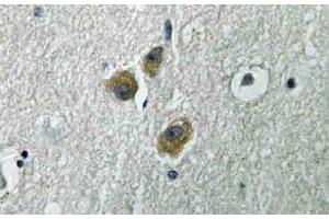 Immunohistochemistry (IHC) analyzes of ME3 antibody in paraffin-embedded human brain tissue. (ME3 antibody)