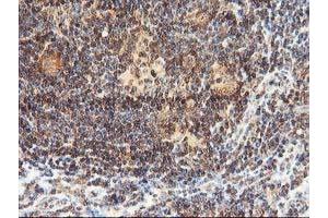 Image no. 7 for anti-Leucine Carboxyl Methyltransferase 1 (LCMT1) antibody (ABIN1499109)