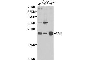 Western blot analysis of extracts of various cell lines, using CGB Antibody. (Chorionic Gonadotropin, beta Polypeptide 3 (CGB3) antibody)