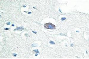 Image no. 2 for anti-Interleukin-1 Receptor-Associated Kinase 3 (IRAK3) antibody (ABIN317722) (IRAK3 antibody)
