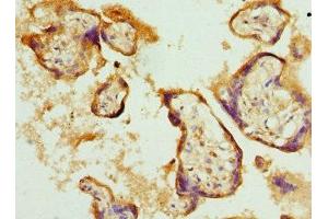 Immunohistochemistry of paraffin-embedded human placenta tissue using ABIN7145330 at dilution of 1:100 (BNIP2 antibody  (AA 125-280))