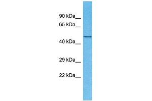 Host: Rabbit Target Name: TMEM194A Sample Type: Fetal Kidney lysates Antibody Dilution: 1. (TMEM194A antibody  (N-Term))