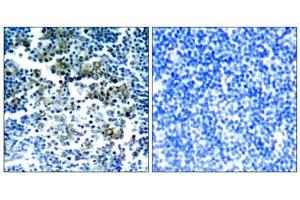 Immunohistochemical analysis of paraffin-embedded human tonsil tumor tissue, using Bcr (phospho-Tyr177) antibody (E011199). (BCR antibody  (pTyr177))