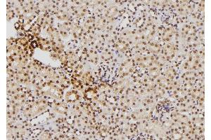ABIN6276386 at 1/100 staining Mouse kidney tissue by IHC-P. (S100B antibody  (C-Term))