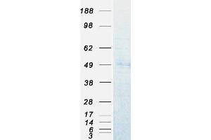 Embryonic Ectoderm Development (EED) (Transcript Variant 2) protein (Myc-DYKDDDDK Tag)