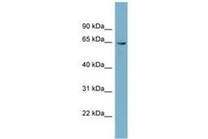 Image no. 1 for anti-Phosphoglucomutase 3 (PGM3) (AA 107-156) antibody (ABIN6741932)