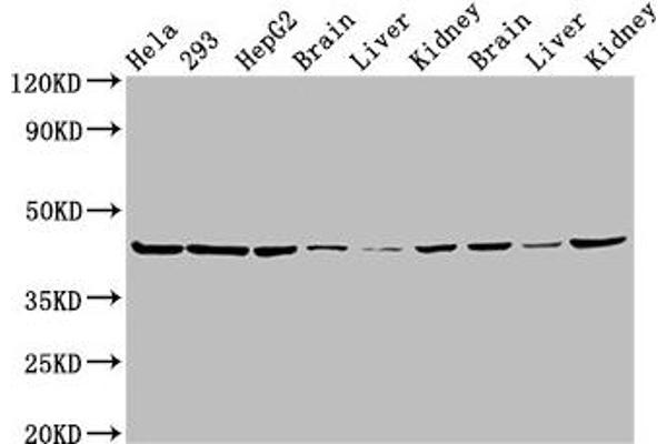 PSMC6 antibody  (Regulatory Subunit 10B)