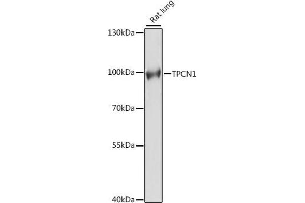 TPCN1 Antikörper  (AA 692-816)