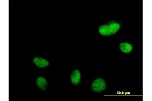 Immunofluorescence of purified MaxPab antibody to N-PAC on HeLa cell.