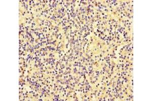 Immunohistochemistry of paraffin-embedded human spleen tissue using ABIN7176672 at dilution of 1:100 (SLC3A1 antibody  (AA 58-278))