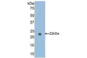 Detection of Recombinant FTMT, Mouse using Polyclonal Antibody to Ferritin, Mitochondrial (FTMT) (Ferritin Mitochondrial antibody  (AA 54-229))