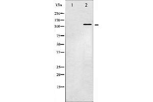 Western blot analysis of JAK2 phosphorylation expression in K562 whole cell lysates,The lane on the left is treated with the antigen-specific peptide. (JAK2 antibody  (pTyr221))