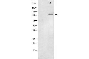 Western blot analysis of JAK2 phosphorylation expression in K562 whole cell lysates,The lane on the left is treated with the antigen-specific peptide. (JAK2 antibody  (pTyr221))