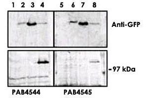 Upper panel, western blot analysis of GFP fusion protein expression in Panc-1 cells by using an PRKD3 polyclonal antibody  . (PRKD3 antibody  (C-Term))