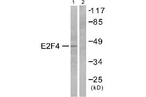 Western blot analysis of extracts from COS7 cells, usingantibody (#C0178). (E2F4 antibody)