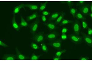 Immunofluorescence analysis of A549 cells using APTX Polyclonal Antibody (Aprataxin antibody)