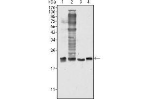 Western blot analysis using SOD1 mouse mAb against Hela (1), NIH/3T3 (2), A549 (3) and A431 (4) cell lysate. (SOD1 antibody)
