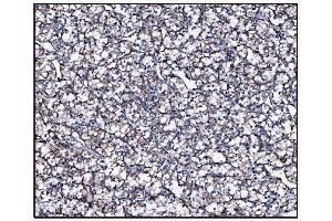 IHC analysis of FABP-1/GOT2 using anti-FABP-1/GOT2 antibody (ABIN7601426). (GOT2 antibody  (AA 35-430))