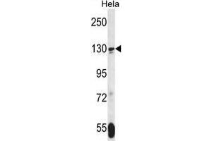 TNKS Antibody (N-term) western blot analysis in Hela cell line lysates (35 µg/lane).