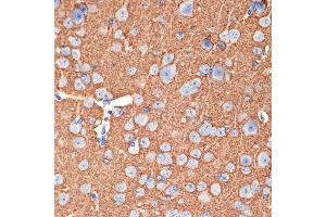 Immunohistochemistry (IHC) image for anti-Syntaxin 1B (STX1B) antibody (ABIN7270685)