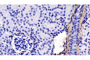 Detection of COL1a1 in Human Kidney Tissue using Monoclonal Antibody to Collagen Type I Alpha 1 (COL1a1) (COL1A1 antibody  (AA 253-471))
