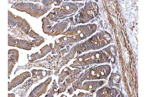 IHC-P Image RRM2 antibody [N1C1] detects RRM2 protein at cytoplasm on mouse intestine by immunohistochemical analysis. (RRM2 antibody  (Regulatory Subunit))
