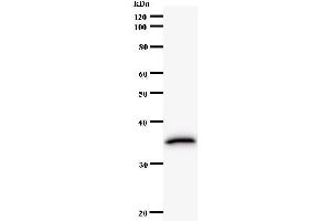 Western Blotting (WB) image for anti-Translin-Associated Factor X (TSNAX) antibody (ABIN932466)