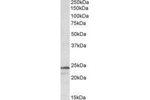 Western Blotting (WB) image for anti-Proteasome Subunit beta 3 (PSMB3) (Internal Region) antibody (ABIN2464725) (PSMB3 antibody  (Internal Region))