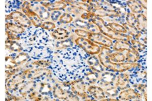 ABIN6262943 and ABIN6277882 at 1/100 staining Rat kidney tissue by IHC-P. (LDLR antibody  (Internal Region))