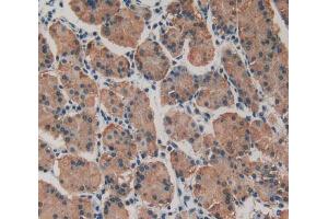 Used in DAB staining on fromalin fixed paraffin- embedded stomach tissue (MYH10 antibody  (AA 438-716))