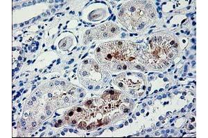 Immunohistochemical staining of paraffin-embedded Human Kidney tissue using anti-PDE6G mouse monoclonal antibody. (PDE6G antibody)