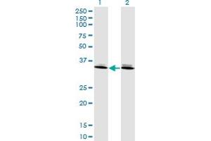 Western Blot analysis of DLX6 expression in transfected 293T cell line by DLX6 monoclonal antibody (M06), clone 2D7. (DLX6 antibody  (AA 71-160))