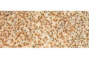 Immunohistochemistry of paraffin-embedded Human tonsil tissue using HIST1H2BA Polyclonal Antibody at dilution of 1:45(x200)