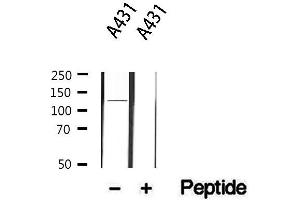 Western blot analysis of extracts from A431, using ITGA6 Antibody. (ITGA6 antibody  (N-Term))