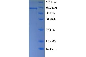 SDS-PAGE (SDS) image for Regulator of G-Protein Signaling 7 (RGS7) (AA 1-487), (full length) protein (His tag) (ABIN5710256) (RGS7 Protein (AA 1-487, full length) (His tag))