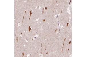 Immunohistochemical staining (Formalin-fixed paraffin-embedded sections) of human hippocampus with SCG3 polyclonal antibody  shows cytoplasmic positivity in neurons.