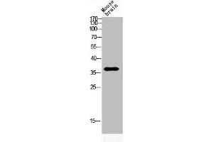 Western blot analysis of MOUSE-BRAIN lysis using ART1 antibody. (ART1 antibody  (Internal Region))