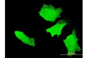 Immunofluorescence of monoclonal antibody to APC on HeLa cell. (APC antibody  (AA 2744-2843))