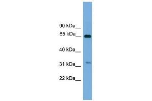 UBXD3 antibody used at 1 ug/ml to detect target protein. (UBXN10 antibody  (Middle Region))