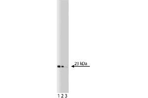 Western blot analysis of Bid on a Jurkat cell lysate (Human T-cell leukemia, ATCC TIB-152). (BID antibody  (AA 50-62))