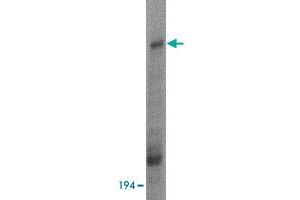 Western blot analysis of HUWE1 in Daudi cell lysate with HUWE1 polyclonal antibody  at 1 ug/mL . (HUWE1 antibody  (C-Term))