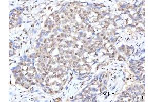 IHC analysis of RANBP2 using anti-RANBP2 antibody (ABIN7602650). (RANBP2 antibody  (AA 906-2744))